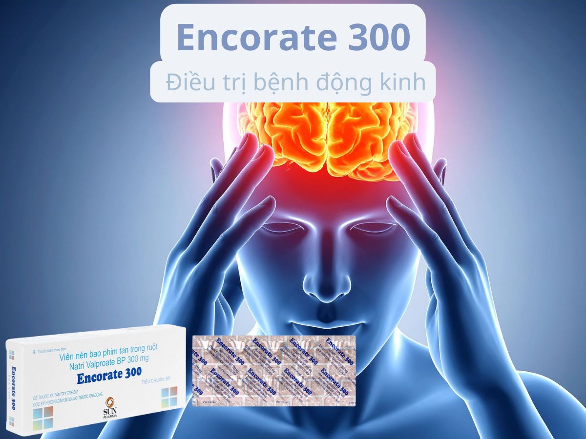 Encorate 300 13 Encorate 300