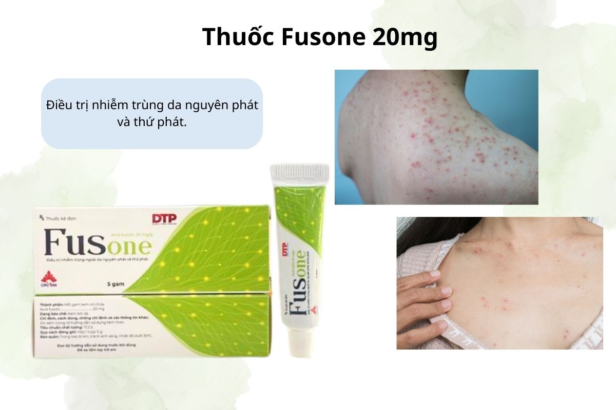 Fusone 20mg 10 fusone-20mg