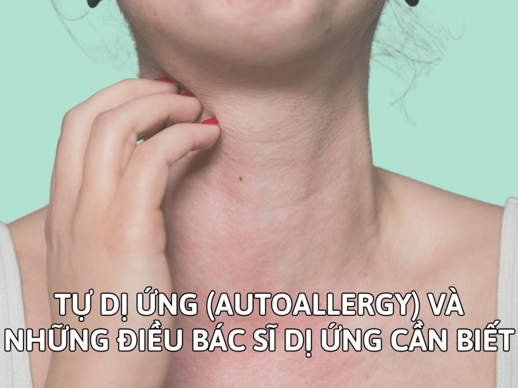 TỰ DỊ ỨNG (AUTOALLERGY) VÀ NHỮNG ĐIỀU Nhà Cái HM88.COM Slot Game, Casino Live DỊ ỨNG CẦN BIẾT 2 TỰ DỊ ỨNG (AUTOALLERGY) VÀ NHỮNG ĐIỀU Nhà Cái HM88.COM Slot Game, Casino Live DỊ ỨNG CẦN BIẾT