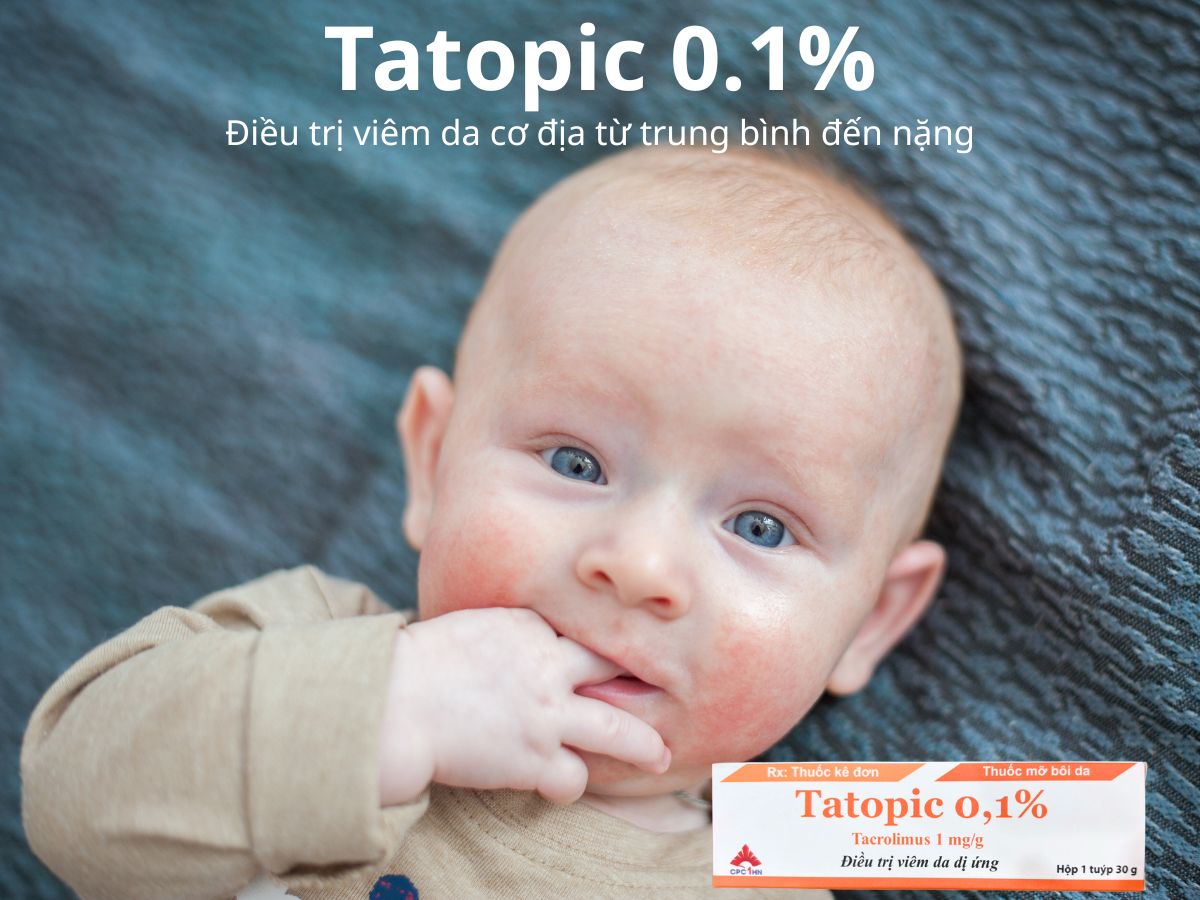 Tatopic 0.1% 8 Tatopic 0.1%