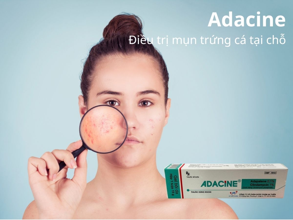Adacine 10 Adacine