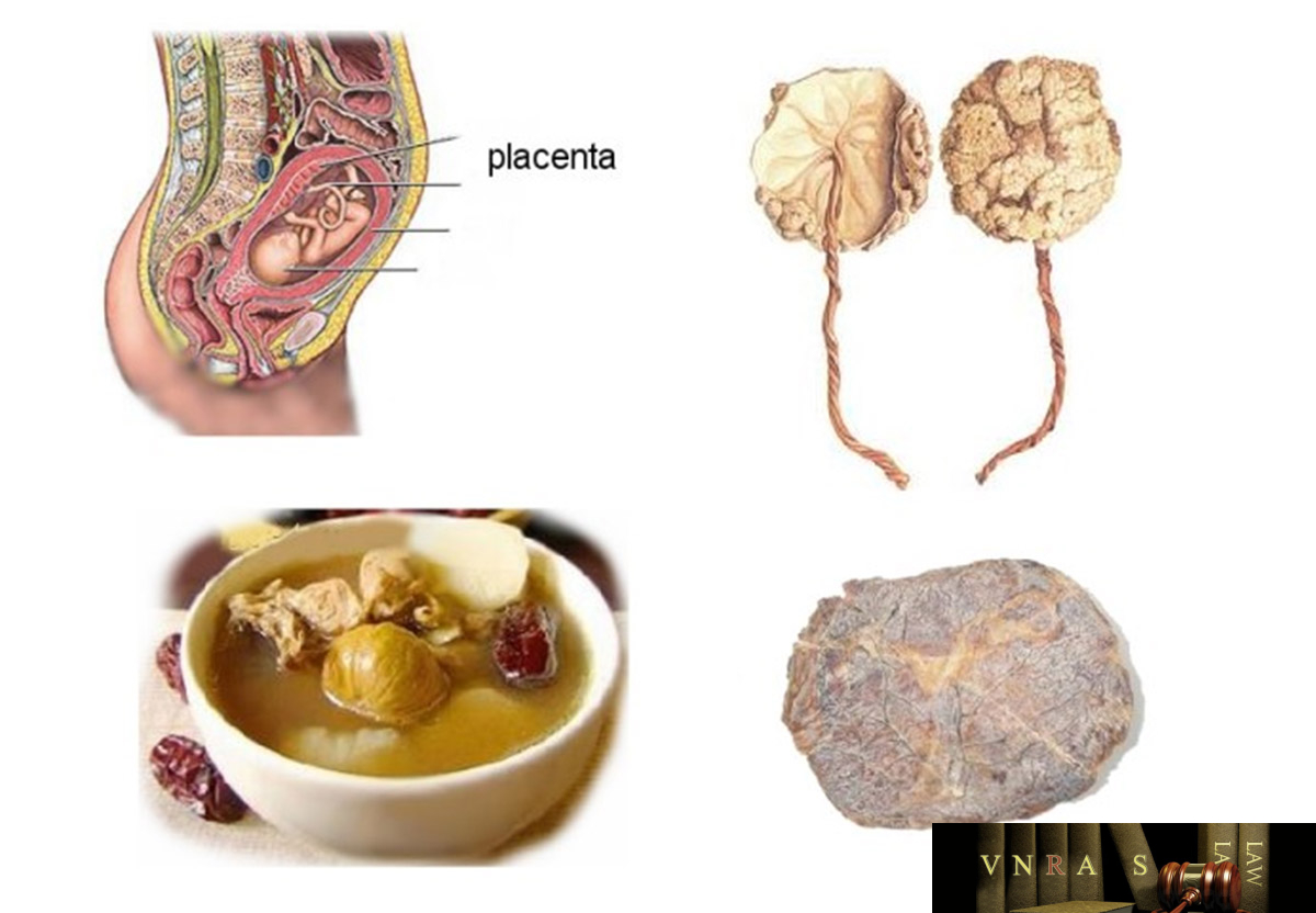 Nhau sản phụ