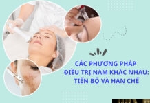 Các phương pháp điều trị nám khác nhau: Tiến bộ và hạn chế Các phương pháp điều trị nám khác nhau: Tiến bộ và hạn chế