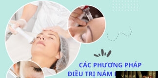 Các phương pháp điều trị nám khác nhau: Tiến bộ và hạn chế Các phương pháp điều trị nám khác nhau: Tiến bộ và hạn chế